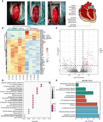 Association of Pericardiac Adipose Tissue With Coronary Artery Disease